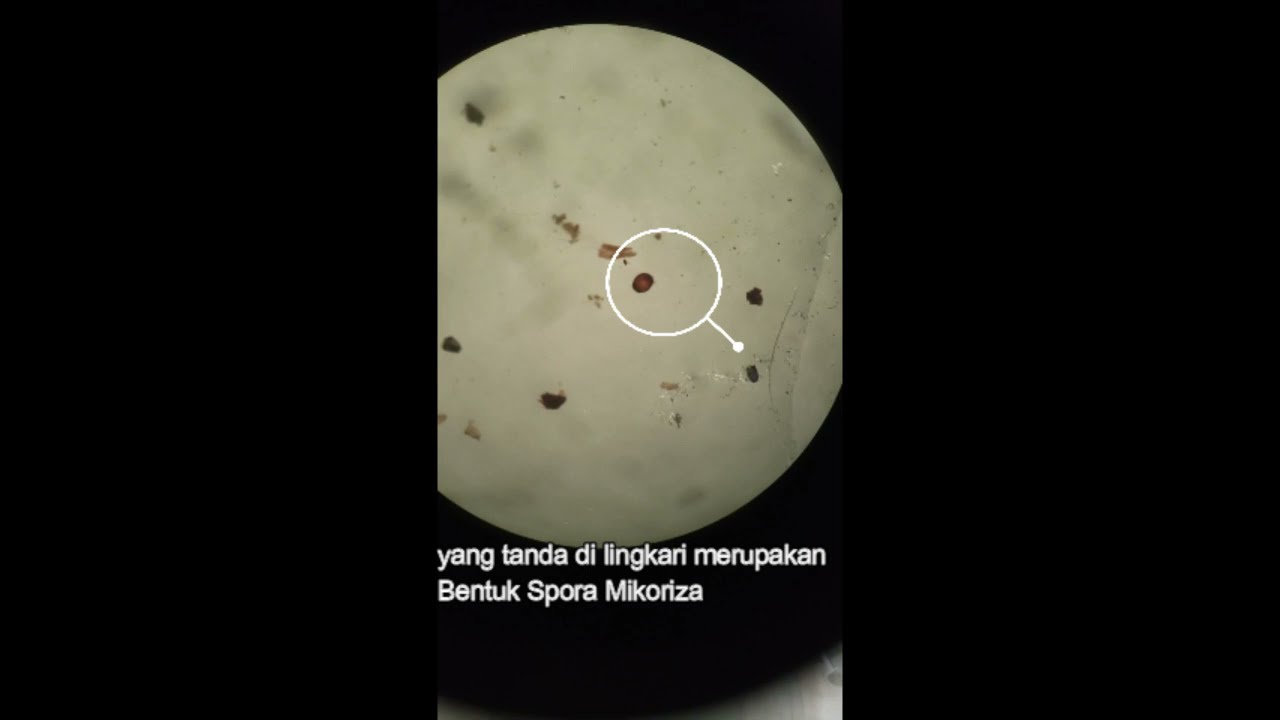 Gosok Daripada Spora Cendawan yang Bercampur dengan DNA Anda: Apakah Mungkin?
